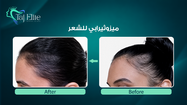 before-^-after8